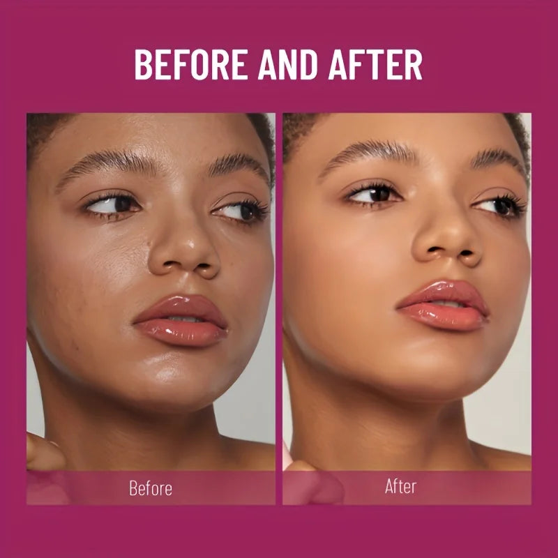 Full Coverage Sponge-Tip Concealer – Dark Circles, Blemishes & Acne